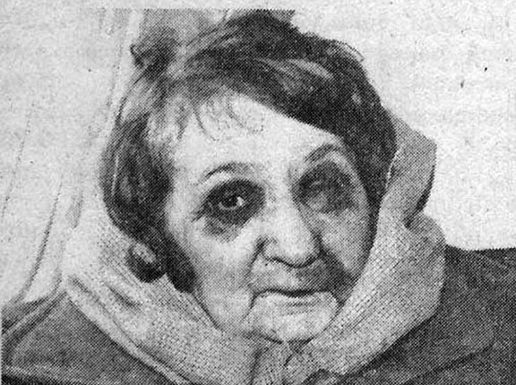 Armenian woman left abused following the Azeri pogroms. (Source: Public Radio of Armenia)